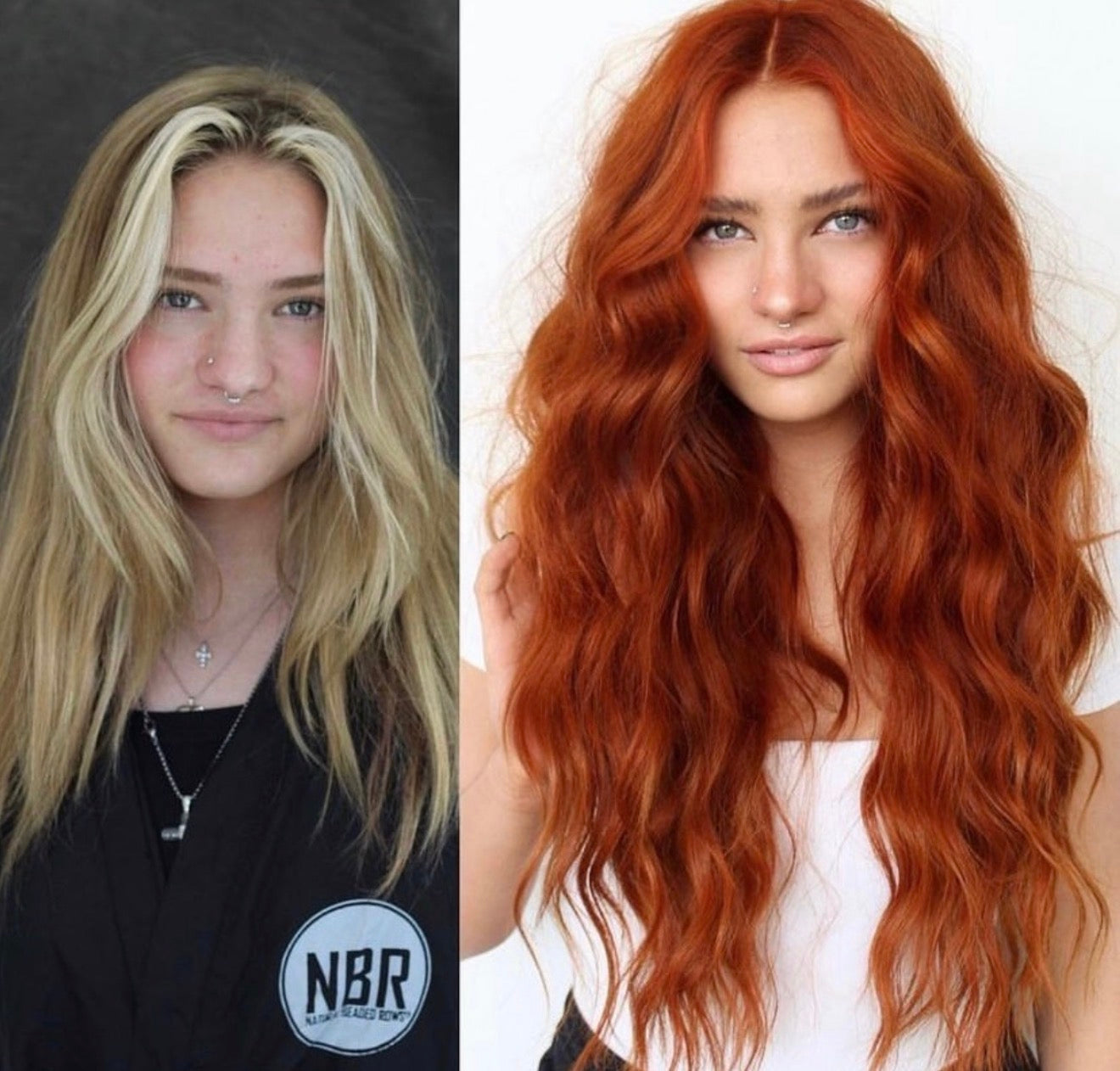 Hair Surgery ❤️‍🔥